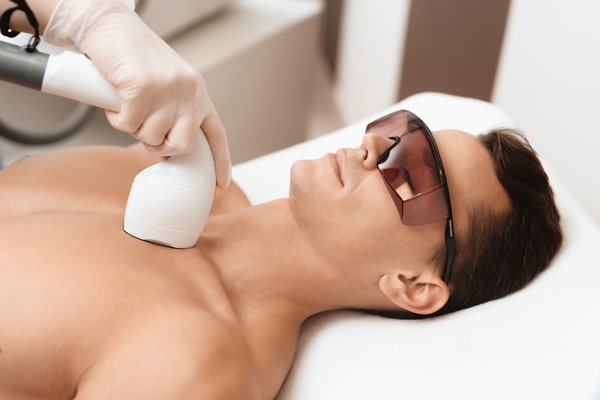 Laser hair removal 2